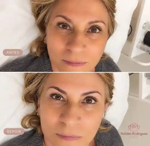 Antes e depois — Design de sobrancelha